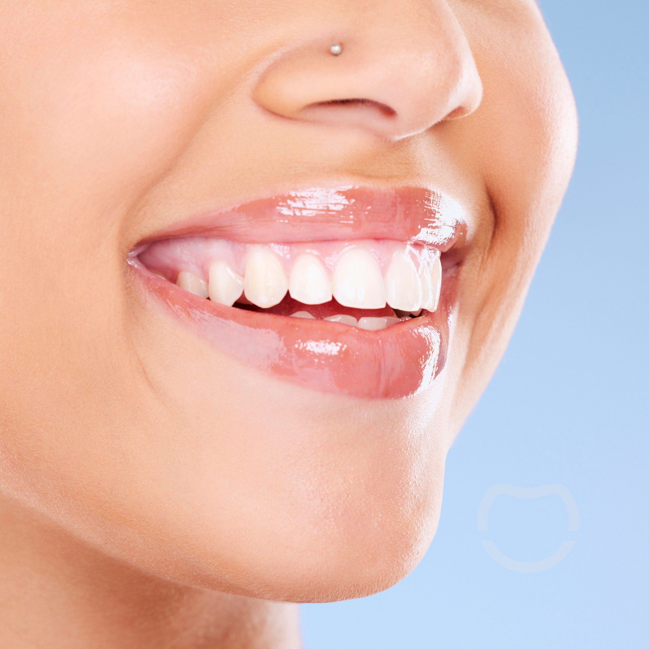 teeth whitening in johnstone glasgow -dentist in johnstone